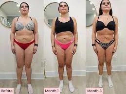 Ozempic Weight Loss Before And After